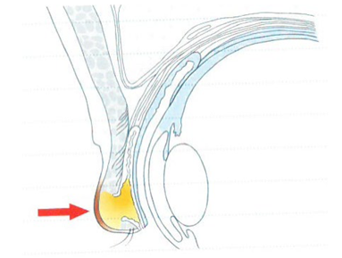 早く切った方が良いタイプ