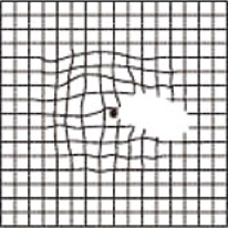 部分的に欠けて見える