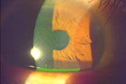 全体的に細かい傷