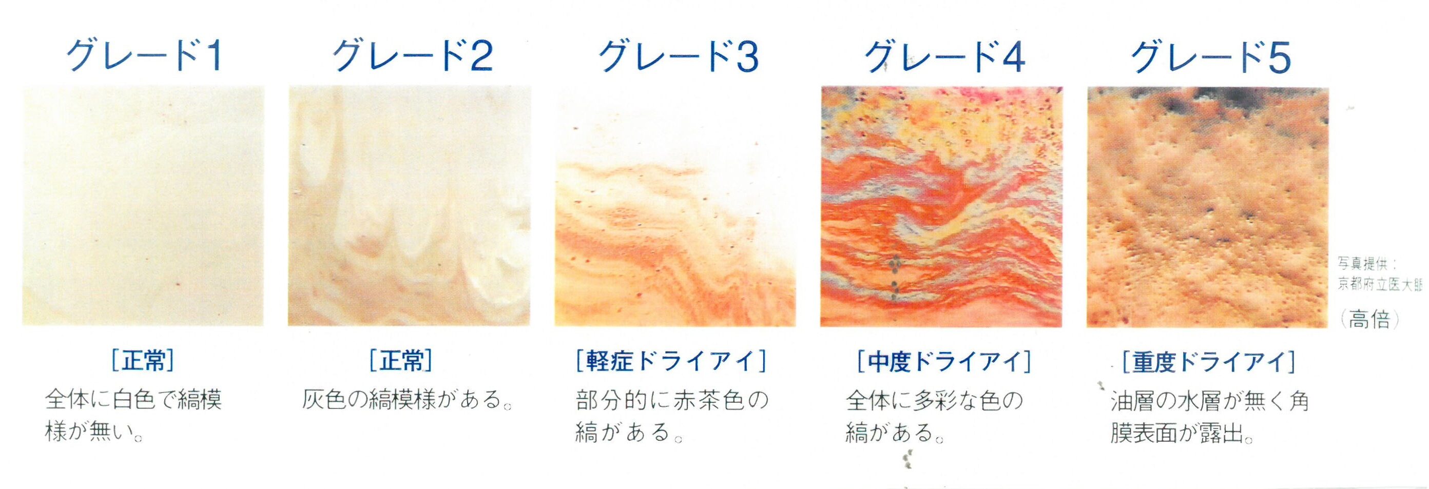 ドライアイ観察装置 DR-1