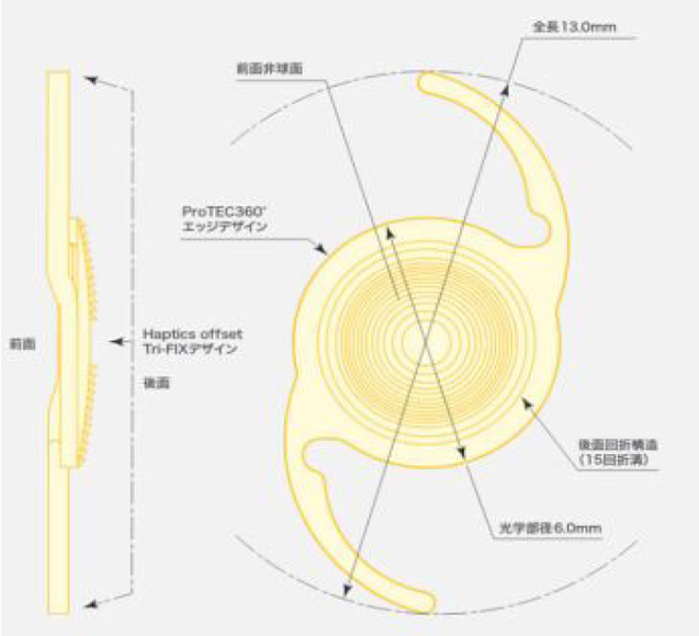 テクニスオデッセイ・トーリック