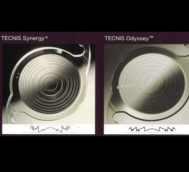 テクニスオデッセイ・トーリック