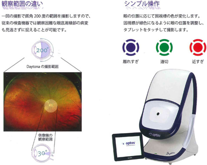 超広角走査レーザー検眼鏡（オプトスデイトナ）